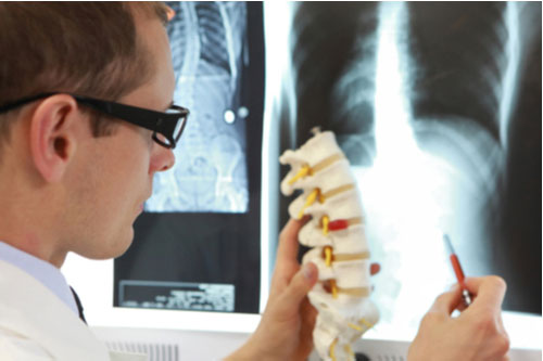 concept of Naples spine injury treatment, doctor viewing spinal x-ray